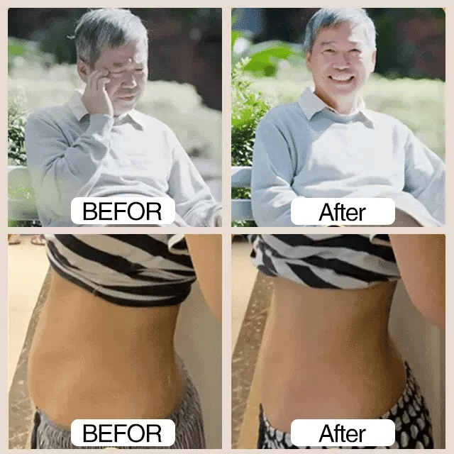 Sugar Control LI4 Acupressure Point Clip (Backed by Science!) – Balance Your Sugar Naturally!