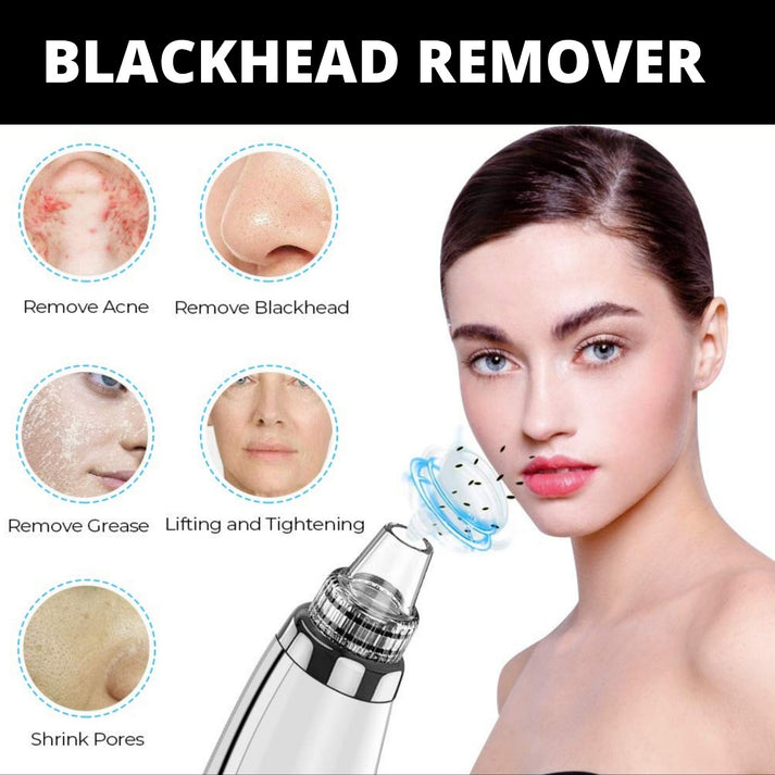 Original Imported 5-in-1 Rechargeable Blackhead Remover & Face Pore Vacuum Cleaner | Deep Clean | 30% OFF Today Only