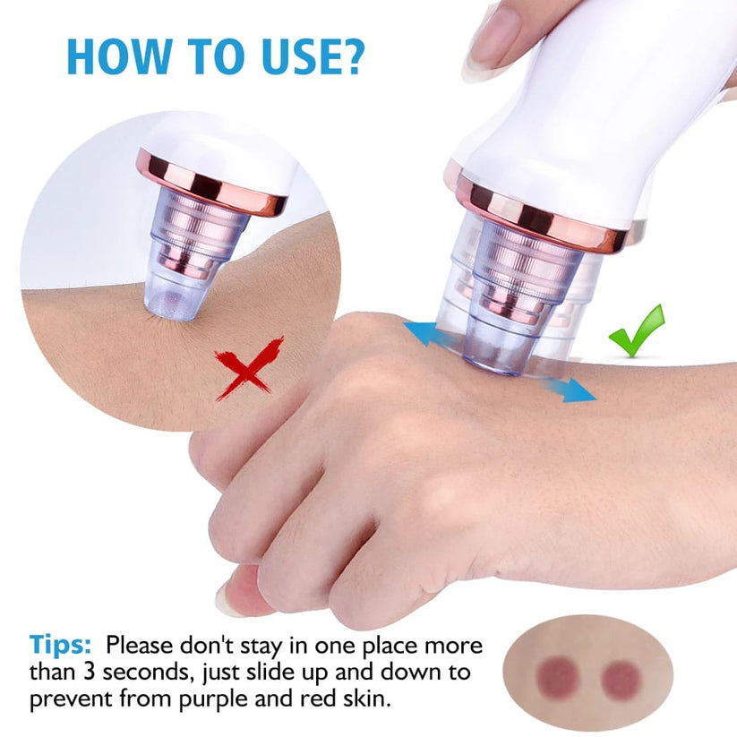 Original Imported 5-in-1 Rechargeable Blackhead Remover & Face Pore Vacuum Cleaner | Deep Clean | 30% OFF Today Only