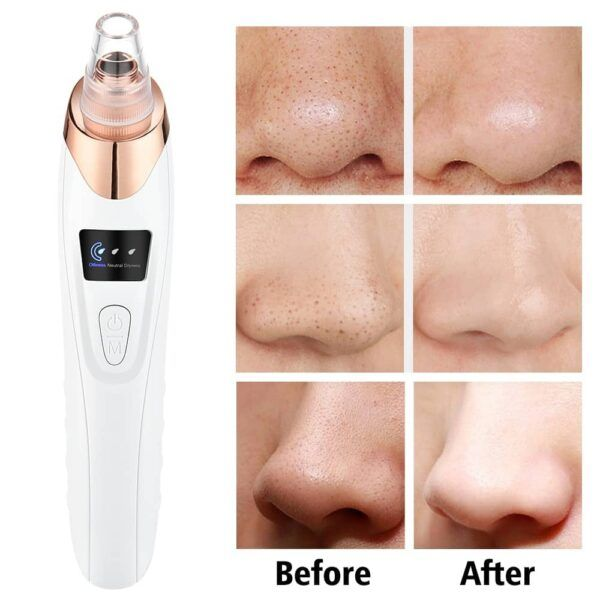 Original Imported 5-in-1 Rechargeable Blackhead Remover & Face Pore Vacuum Cleaner | Deep Clean | 30% OFF Today Only