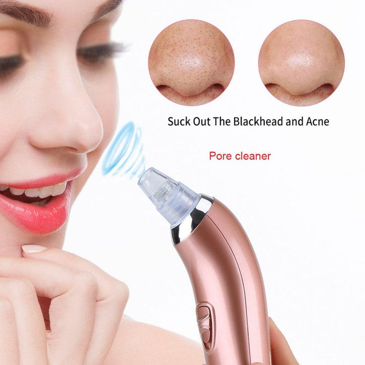 Original Imported 5-in-1 Rechargeable Blackhead Remover & Face Pore Vacuum Cleaner | Deep Clean | 30% OFF Today Only